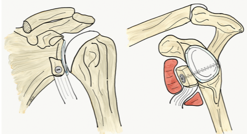 anatomie de l'epaule