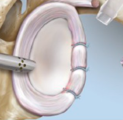 anatomie de l'epaule